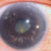 Клиника Центр хирургии глаза фото 5 на сайте Ostankino.su