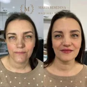 Клиника косметологии Marikosma фото 16 на сайте Ostankino.su
